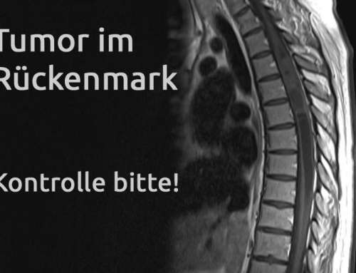 Tumor im Rückenmark – Erfahrungsbericht Teil 25